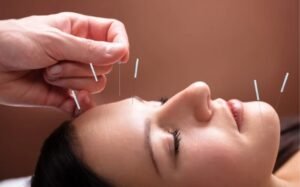 How to Boost Patient Retention and Build a Thriving Acupuncture Practice