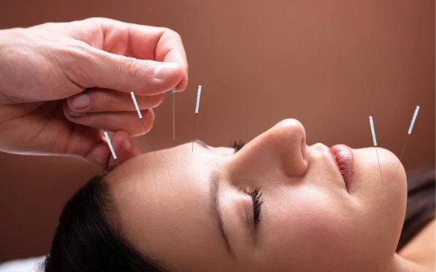 How to Boost Patient Retention and Build a Thriving Acupuncture Practice